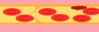 ʲôL(fng)